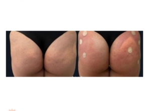 Foto de Espaço Corpo e Cia Ilma Salles em Duque de Caxias, RJ por Solutudo