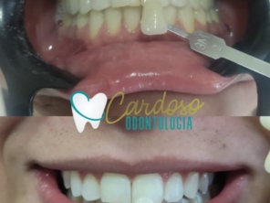 Foto de Odontologia Cardoso em Sarandi, PR por Solutudo