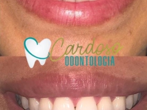 Foto de Odontologia Cardoso em Sarandi, PR por Solutudo