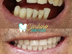 Foto de Odontologia Cardoso em Sarandi, PR por Solutudo
