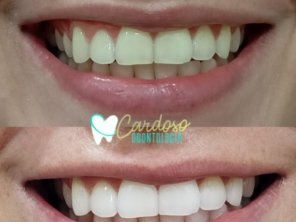 Foto de Odontologia Cardoso em Sarandi, PR por Solutudo