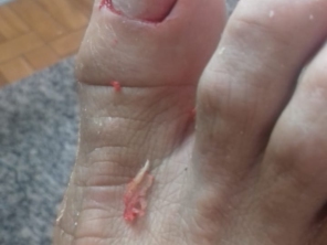 Trabalhamos com: -Unha encravada (com ou sem infecção) -Curvatura acentuada da unha -Calos e Calosidades(hidratação profunda e esfoliação) -Fissuras e Rachaduras -Pés diabéticos -Verruga Plantar -Aplicação de Órtese(aparelho para correção da unha).  

Realizamos tratamento com todo material esterelizado em auto-clave, sempre nos dedicando a comodidade e conforto do cliente. 

Com privacidade e hora marcada. Podóloga com formação no SENAC - SP em atividade desde 2005!  Atendimento domiciliar para portadores de necessidades especiais!