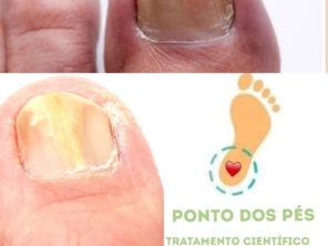 Foto de Ponto dos Pés - Clínica de podologia em Bauru em Bauru, SP por Solutudo