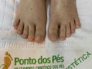 Foto de Ponto dos Pés - Clínica de podologia em Bauru em Bauru, SP por Solutudo