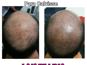 Foto de Laiane Lima Beleza e Estética em Ourinhos, SP por Solutudo