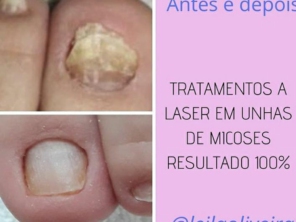 Foto de Podologia - Leila Oliveira em Mineiros, GO por Solutudo