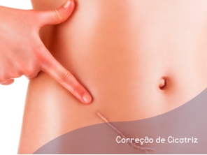 Correção cicatricial é a cirurgia plástica realizada para melhorar a condição ou a aparência de uma cicatriz em qualquer parte do corpo.  O tipo de cicatriz que você tem irá determinar as técnicas adequadas que o cirurgião plástico irá usar para suavizar a cicatriz.