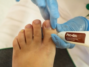 Produto específico para o tratamento de micose. O Pro-gel é um antimicótico natural composto por óleos essenciais, que ajudam você a tratar de micoses a frieiras de pele e de unhas, e eliminam coceiras e irritações na pele.