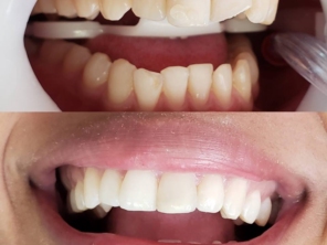 Foto de Help Dente Odontologia em Bauru, SP por Solutudo