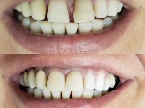 Foto de Help Dente Odontologia em Bauru, SP por Solutudo