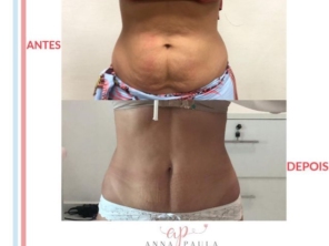Foto de Estética Anna Paula em Aracaju, SE por Solutudo