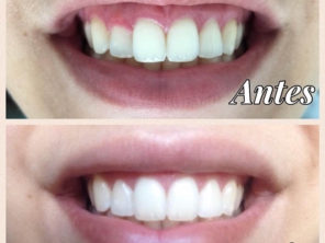 Foto de Uniclinic Cirurgião Dentista - Dr. Jefferon Lopes Pedroso e Dra. Elaine Fátima Mazuqueli Pedroso em Marília, SP por Solutudo