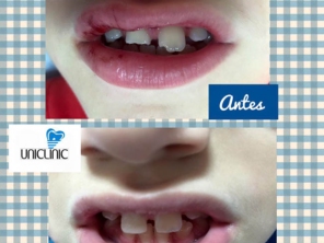 Foto de Uniclinic Cirurgião Dentista - Dr. Jefferon Lopes Pedroso e Dra. Elaine Fátima Mazuqueli Pedroso em Marília, SP por Solutudo