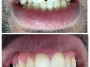 Foto de Uniclinic Cirurgião Dentista - Dr. Jefferon Lopes Pedroso e Dra. Elaine Fátima Mazuqueli Pedroso em Marília, SP por Solutudo