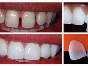 Foto de Uniclinic Cirurgião Dentista - Dr. Jefferon Lopes Pedroso e Dra. Elaine Fátima Mazuqueli Pedroso em Marília, SP por Solutudo