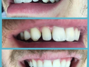 Foto de Uniclinic Cirurgião Dentista - Dr. Jefferon Lopes Pedroso e Dra. Elaine Fátima Mazuqueli Pedroso em Marília, SP por Solutudo