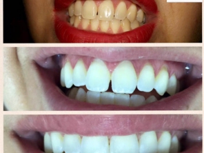 Foto de Uniclinic Cirurgião Dentista - Dr. Jefferon Lopes Pedroso e Dra. Elaine Fátima Mazuqueli Pedroso em Marília, SP por Solutudo