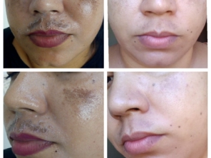 Foto de Hátila Muzi Esteticista em Marília, SP por Solutudo