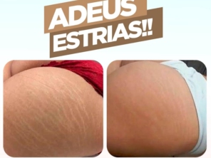 Foto de Hátila Muzi Esteticista em Marília, SP por Solutudo