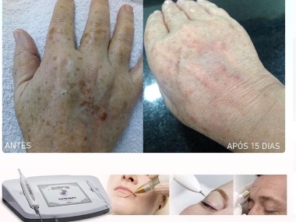 Foto de Hátila Muzi Esteticista em Marília, SP por Solutudo
