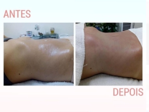 Foto de Hátila Muzi Esteticista em Marília, SP por Solutudo
