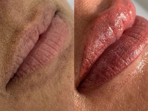 Foto de Dayane Moro - Estética avançada em Jundiaí, SP por Solutudo