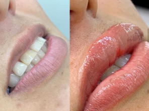 Foto de Dayane Moro - Estética avançada em Jundiaí, SP por Solutudo
