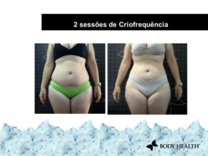 Foto de Estética França em Igarapé, MG por Solutudo