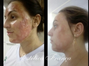 Foto de Estética França em Igarapé, MG por Solutudo