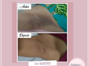 Foto de Estética França em Igarapé, MG por Solutudo