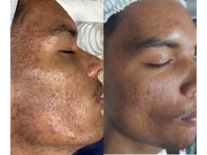 Foto de Anita Lopes | Clínica de Estética Avançada e Harmonização em Novo Gama, GO por Solutudo