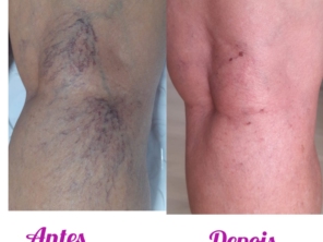 Foto de Anita Lopes | Clínica de Estética Avançada e Harmonização em Novo Gama, GO por Solutudo