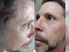 Foto de Anita Lopes | Clínica de Estética Avançada e Harmonização em Novo Gama, GO por Solutudo