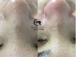 Foto de Beleza e Estética Jeane Lima - Esteticista em Presidente Dutra, MA por Solutudo