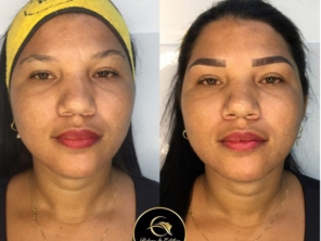 Foto de Beleza e Estética Jeane Lima - Esteticista em Presidente Dutra, MA por Solutudo