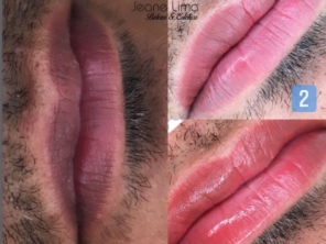 Foto de Beleza e Estética Jeane Lima - Esteticista em Presidente Dutra, MA por Solutudo