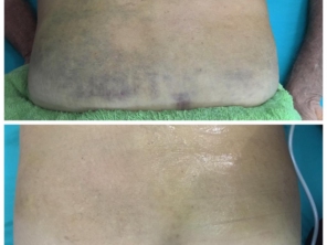 Foto de Clinica Ala Fisio em Humaitá, AM por Solutudo