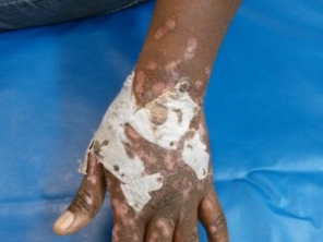 Foto de SuaVidaDe Cuidados Especiais com sua Pele em São Paulo, SP por Solutudo