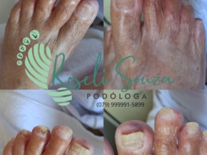 Foto de Roseli Souza Podologia em Aracaju, SE por Solutudo