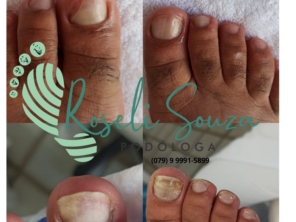Foto de Roseli Souza Podologia em Aracaju, SE por Solutudo
