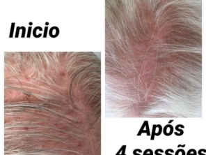 Foto de LNV Ozonioterapia em Suzano, SP por Solutudo