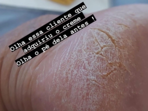 Foto de Ângela Cardoso Podologa em Marília, SP por Solutudo