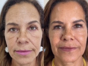 Foto de Revitalize-se Estética Humanizada em Jundiaí, SP por Solutudo