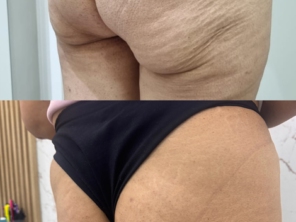 Foto de Revitalize-se Estética Humanizada em Jundiaí, SP por Solutudo
