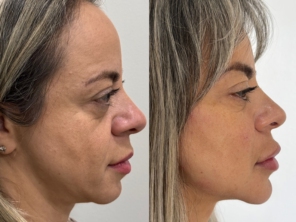 Foto de Revitalize-se Estética Humanizada em Jundiaí, SP por Solutudo