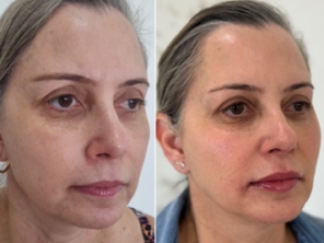 Foto de Revitalize-se Estética Humanizada em Jundiaí, SP por Solutudo