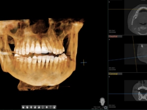 Bucalx Radiologia Odontológica