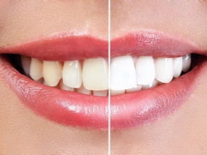 Foto de Dra. Isabela Ervolino - Cirurgiã Dentista - Comfil em Valparaíso, SP por Solutudo