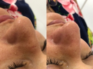 Foto de Dermax estética e saúde em Lauro de Freitas, BA por Solutudo