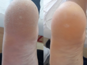 Foto de Dermax estética e saúde em Lauro de Freitas, BA por Solutudo
